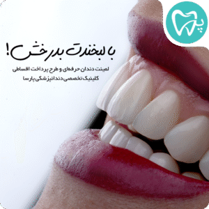 لمینت دندان حرفه‌ای و طرح پرداخت اقساطی کلینیک تخصصی دندانپزشکی پارسا